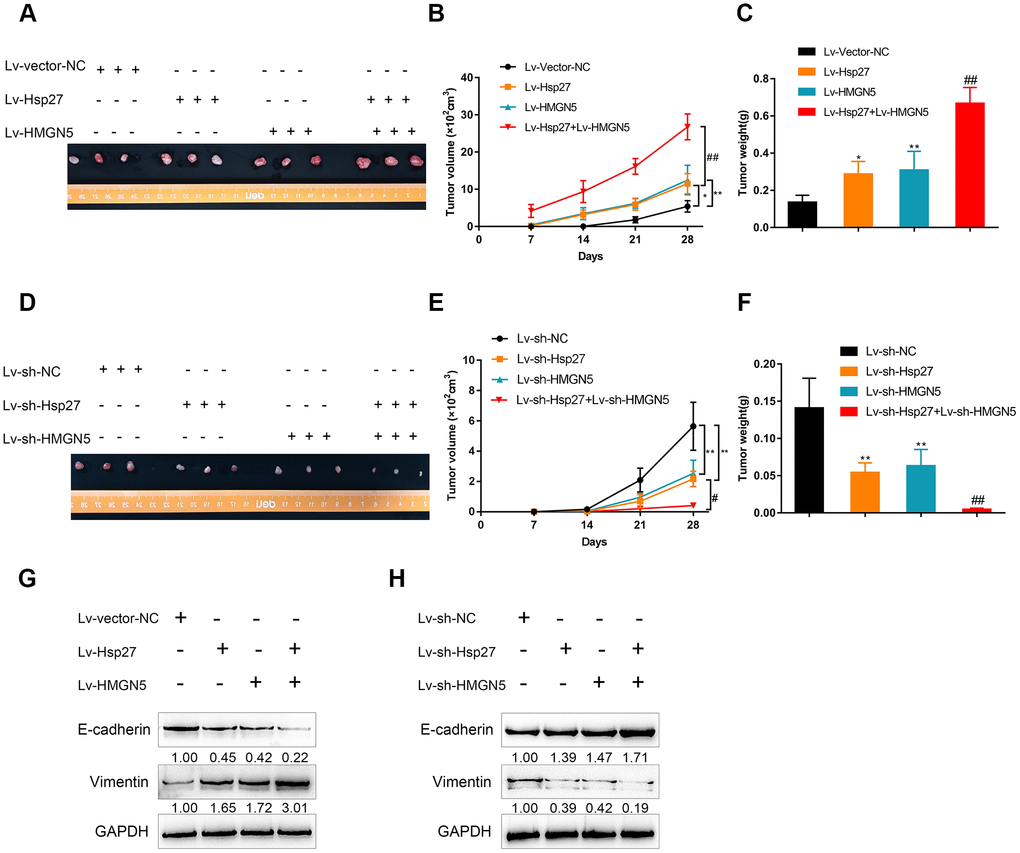 HMGN5 interacts with Hsp27 to modulate tumor growth in a nude mouse model. The appearance (A), tumor volume (B), and tumor weight (C) of tumors derived from Hsp27 and/or HMGN5-overexpressing J82 cells. The appearance (D), tumor volume (E), and tumor weight (F) of tumors derived from Hsp27 and/or HMGN5 silenced J82 cells. (G) The protein levels of E-cadherin and Vimentin in tumors derived from Hsp27 and/or HMGN5 overexpressing J82 cells. (H) The protein levels of E-cadherin and Vimentin in tumors derived from Hsp27 and/or HMGN5 silenced J82 cells. The data are presented as the mean ± SD of three independent experiments. *PP##P