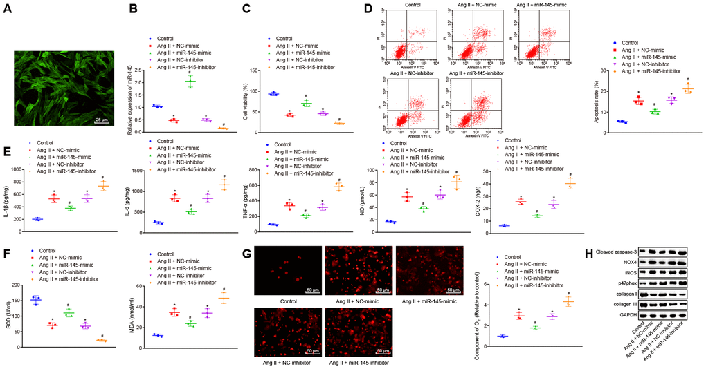 miR-145 suppresses the apoptosis, inflammatory reaction, and oxidative stress of VSMCs treated with Ang II. (A) the expression of the molecular marker α-SM-actin of VSMCs isolated by immunofluorescence assay (× 400); (B) miR-145 expression in VSMCs determined using RT-qPCR; (C) viability of VSMCs detected by CCK-8 assay; (D) apoptosis of VSMCs detected by flow cytometry; (E) levels of COX-2, NO, IL-1β, IL-6, and TNF-α in serum of VSMCs measured by ELISA; (F) levels of MDA and SOD in serum of VSMCs measured using kits; (G) O2- in VSMCs measured using DHE staining (× 400); (H) protein levels of cleaved caspase-3, NOX4, iNOS, p47phox, collagen I and collagen III in VSMCs determined using Western blot analysis; *, p vs. VSMCs without treatment; #, p vs. VSMCs treated with Ang II + LV-miR-NC or Ang II+LV-NC-inhibitor plasmids; measurement data were depicted as the mean ± standard deviation; comparisons among multiple groups were analyzed using one-way ANOVA followed by Turkey’s post hoc test; the experiment was repeated three times.