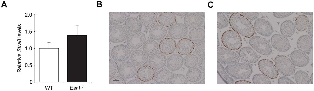 Lack of effect of Esr1 gene disruption in testes of adult male mice. (A) Quantitative analysis of Stra8 mRNA levels in testes of wild type (WT) and Esr1–/–mice at 3 months of age (mean ± SEM; n = 3 mice per group). (B, C) Histological appearance of the testes of WT (B) and Esr1–/– (C) mice at 3 months of age, after fixation and analysis by immunohistochemistry for Stra8 expression (brown immunoreaction product against a blue hematoxylin counterstain).