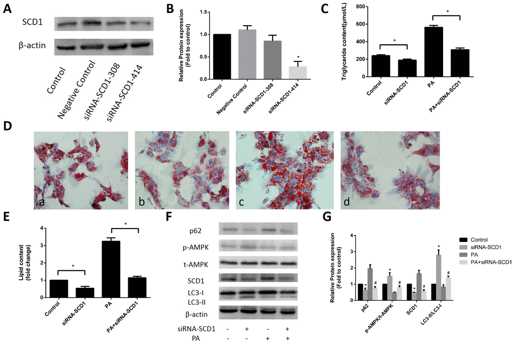 Effects of inhibited SCD1 expression on lipid deposition and activation of AMPK and lipophagy in primary hepatocytes. (A, B) Screening for the appropriate siRNA-SCD1 by Western blotting. (C) TG levels were measured after transfection with siRNA-SCD1. (D) Primary hepatocytes were stained with Oil Red O. a, control group; b, siRNA-SCD1 group; c, PA group; d, PA+siRNA-SCD1 group. (E) The intracellular lipid content in each group was quantified. (F, G) Protein levels were determined by Western blotting. The data are presented as the means±SDs. *p  versus control, #p  versus the PA group.