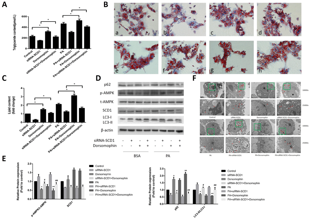 Effects of cotreatment with siRNA-SCD1 and the AMPK inhibitor on lipid deposition and lipophagy in primary hepatocytes. (A) TG levels were measured. (B) Primary hepatocytes were stained with Oil Red O. a, control group; b, siRNA-SCD1 group; c, Dorsomophin group; d, siRNA-SCD1+Dorsomophin group; e, PA group; f, PA+siRNA-SCD1 group; g, PA+Dorsomophin group; h, PA+siRNA-SCD1+Dorsomophin group. (C) The intracellular lipid content in each group was quantified. (D, E) Protein levels were determined by Western blotting. (F) Autophagosomes and autolysosomes in hepatocytes were observed by TEM. The red arrow indicates autophagosomes and autolysosomes. The data are presented as the means±SDs. *p  versus control, #p  versus the siRNA-SCD1 group, **p  versus the PA group, ##p  versus the PA+siRNA-SCD1 group.