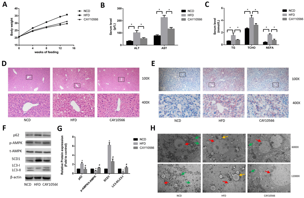 Effects of in vivo inhibition of SCD1 expression on hepatic steatosis and activation of AMPK and lipophagy in mice. (A) The body weights of mice in each group. (B) Levels of serum liver enzymes in mice after 14 weeks (n=6). (C) Levels of serum lipids in mice after 14 weeks (n=6). (D) H&E staining of mouse hepatic tissue (original magnification: 100X and 400X). (E) Oil Red O staining of mouse hepatic tissue (original magnification: 100X and 400X). (F, G) Protein levels were determined by Western blotting. (H) Autophagosomes and autolysosomes in hepatocytes in the liver tissues of mice were observed by TEM. The red arrows indicate hepatocytes, the yellow arrows indicate lipid droplets, and the green arrows indicate autophagosomes and autolysosomes. The data are presented as the means±SDs. *p  versus the NCD group, #p  versus the HFD group.