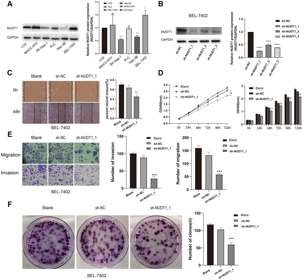 NUDT1 silencing decreases survival, migration, and invasion of HCC cells. (A) Western blot analysis shows NUDT1 expression in HCC cell lines, Hep-3B, SK-Hep-1, PLC, BEL-7402 and MHCC-97H, and the hepatic immortalized cell line, LO2. The relative levels of endogenous NUDT1 expression are shown in the right panel. (B) Western blot analysis shows NUDT1 protein levels in BEL-7402 cells that are transfected with three NUDT1-specific shRNAs (sh-NUDT1