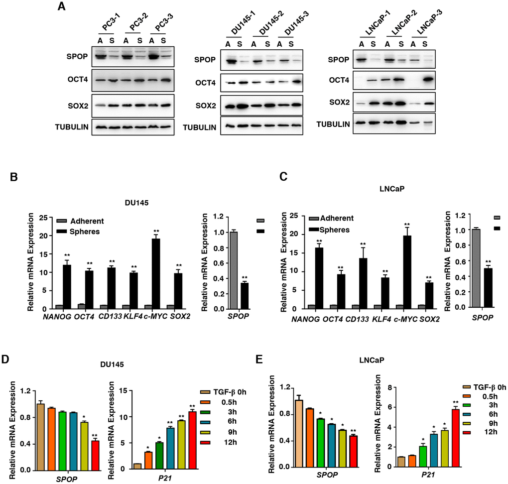 SPOP is regulated by TGF-β Signaling in prostate cancer. (A) Western blot analysis the expression of SPOP in the oncospheres in androgen-independent (DU145, PC3) cell lines and androgen-dependent (LNCaP) cell lines. (B) Real-Time PCR analysis of SPOP and CSCs markers expression in adherent cells versus spheres in DU145 cells. Data are normalized to Actin expression and presented as fold change in gene expression relative to adherent cells. Data are means ± SEM (n=3). **P t-test). (C) Real-Time PCR analysis of SPOP and CSCs markers expression in adherent cells versus spheres in LNCaP cells. Data are normalized to Actin expression and presented as fold change in gene expression relative to adherent cells. Data are means ± SEM (n=3). **P t-test). (D) Analysis the expression of SPOP in the treatment of TGF-β (10ng/ml) in DU145 cells. Data are means ± SEM (n=3). *PP t-test). (E) Analysis the expression of SPOP in the treatment of TGF-β (10ng/ml) in LNCaP cells. Data are means ± SEM (n=3). *PP t-test).