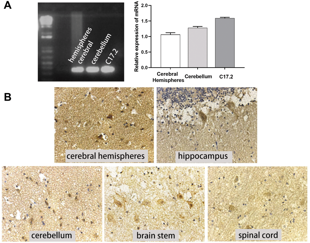 c-Mpl mRNA and protein were expressed in neural cells and tissues. (A) c-Mpl mRNA expression in human cerebral hemisphere, cerebellum, and C17.2 cells was detected by RT-PCR, n = 3. (B) c-Mpl protein expression in human cerebral hemispheres, hippocampus, cerebellum, brain stem, and spinal cord was detected by immunohistochemistry.