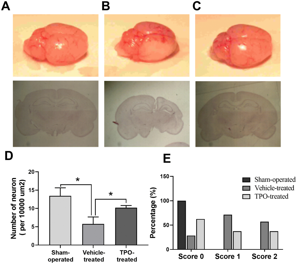 Brain morphology, histology, NSE staining of cortical neurons, and postural reflex test in sham-operated, vehicle-treated, and TPO-treated pups 3 weeks after surgery. Brain morphology and histology were examined at 3 weeks after surgery. Cortical neurons in the ipsilateral hemispheres were detected using NSE staining. (A) Normal external brain morphology and histology of sham-operated pups. (B) Brain morphology and histology of vehicle-treated pups. (C) Brain morphology and histology of TPO-treated pups. (D) The numbers of cortical neurons in the ipsilateral hemispheres of sham-operated, vehicle-treated, and TPO-treated pups, n = 3. (E) Postural reflex test scores in sham-operated (n = 12), vehicle-treated (n = 16), and TPO-treated pups (n = 16). * P 