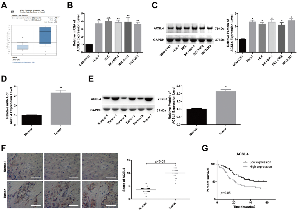 ACSL4 was overexpressed in HCC tissue samples and cells. (A) The Oncomine database was used to retrieve the different expression patterns of ACSL4 in HCC or normal liver. (B, C) The mRNA and protein content of ACSL4 in the human normal liver cell line QSG-7701 and the HCC cell lines Huh-7, HLE, SK-HEP-1, BEL-7402 and HCCLM3 were determined by RT-PCR and western blotting, respectively. (D, E) The mRNA and protein content of ACSL4 in HCC tissues and normal tissues were detected by RT-PCR and western blotting assays. (F) Immunohistochemistry was used to detect ACSL4 protein expression in HCC tissues and normal tissues (Scale bar = 100 μm). (G) Kaplan-Meier analysis of the relationship between ACSL4 expression and the overall survival of patients with HCC. (*P**P
