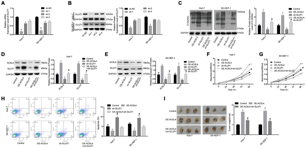 Evaluation of the effects of the ACSL4/GLUT1 axis on cell proliferation, apoptosis and tumorigenesis in Huh-7 and SK-HEP-1 cells. (A, B) The mRNA and protein expression levels of GLUT1 were determined by RT-PCR and western blotting assays after cells were transfected with sh-GLUT1 or sh-NC, respectively (*P**PC–E) Western blotting assays were used to assess the levels of O-GlcNAc, ACSL4 and GLUT1. (F, G) CCK-8 assay was carried out to test cell proliferation. (H) Flow cytometry assay was used to determine cell apoptosis. (I) An in vivo xenotransplantation assay was used to assess the effects of the ACSL4/GLUT1 axis on the tumour formation ability of Huh-7 and SK-HEP-1 cells. (C–I: *P#P