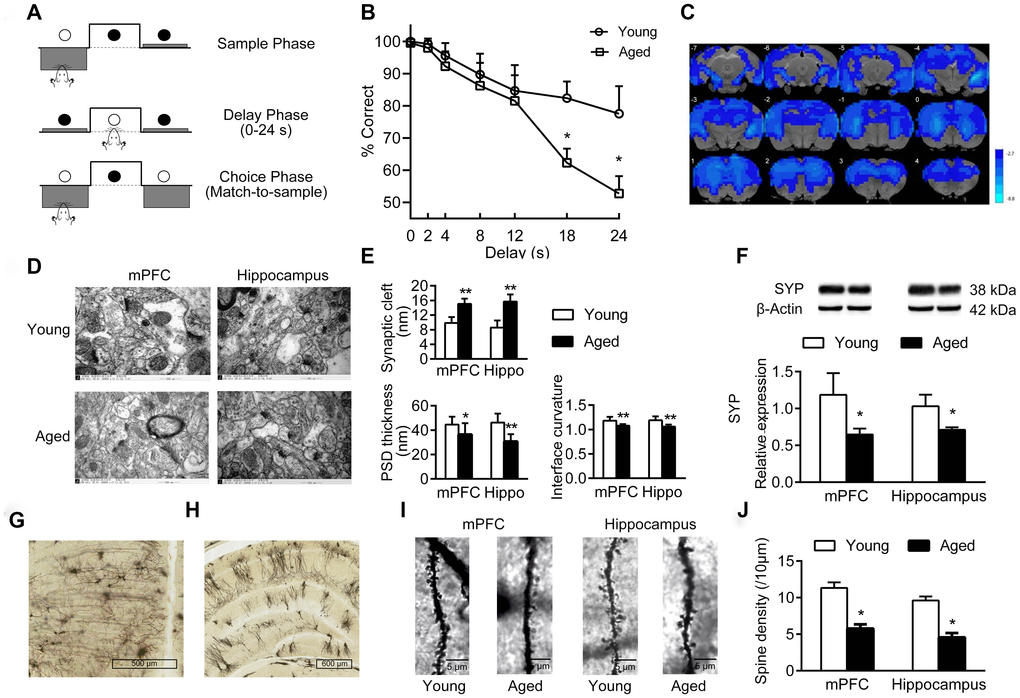 Cognition changes in aged rats. (A) The DMTP procedure, consisting of sample phase, delay phase and choice phase. ○ illumination of the stimulus light or panel light, ● extinguished stimulus light or panel light. (B) Cognitive performance of young and aged rats analyzed by DMTP; n = 12. (C) Images of brain slices showing regions with lower ReHo in aged rats compared with young rats; n = 20. (voxel level  50 voxels). Blue denotes lower ReHo; the color bars indicated the T values between groups. (D) The synaptic structures of mPFC and hippocampus in young and aged rats by transmission electron microscopy (× 60000). n = 3. (E) Histograms of synaptic structure parameters. n = 3. (F) Expression of synaptophysin in mPFC and hippocampus by western blot. SYP: synaptophysin. n = 3. (G–J) Golgi staining performed on mPFC and hippocampus of young and aged rats (n = 3). Representative Golgi staining images of the mPFC (G) and hippocampus (H) demonstrate impregnation of neurons. (I) Representative images of dendritic spines. (J) Quantification of dendritic spine densities in mPFC and hippocampus. Error bars represent the SEM; * P P 