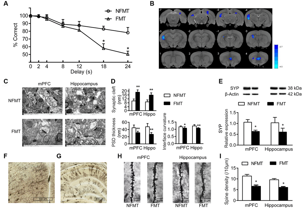 Effect of FMT on cognition in young recipient rats. (A) Effect of FMT on cognitive behavior by DMTP task; n = 12. (B) Images of brain slices showing regions with lower ReHo in FMT group compared with NFMT group (n = 20, voxel level  50 voxels). Blue denotes decreased ReHo; the color bars indicated the T value between two groups. (C) Synaptic structures of mPFC and hippocampus in NFMT and FMT rats. n = 3. (D) Histograms of synaptic structure parameters. n = 3. (E) Expression of synaptophysin in mPFC and hippocampus. (F–I) Golgi staining in NFMT and FMT rats (n = 3). Representative Golgi staining images of mPFC (F) and hippocampus (G) demonstrating impregnation of neurons. (H) Representative images of dendritic spines. (I) Histogram of dendritic spines densities; * P P 