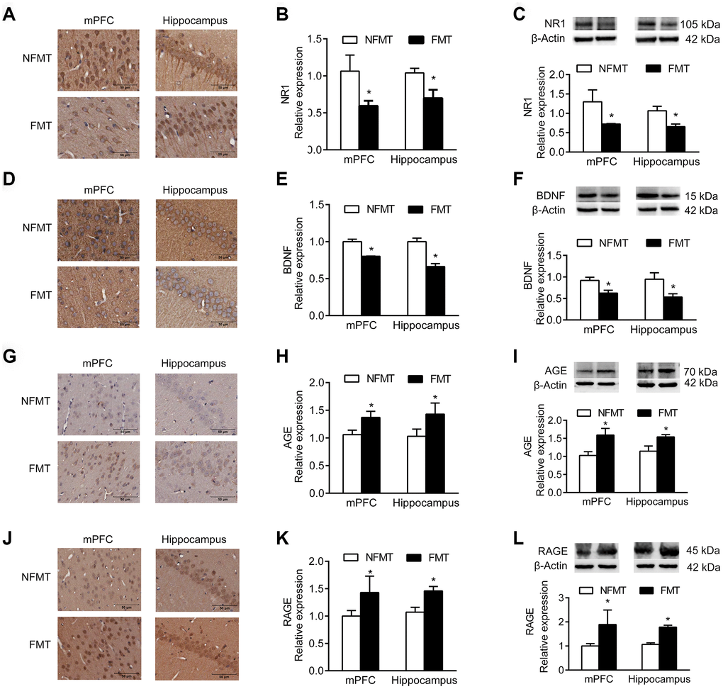 Effect of FMT on expression of molecular markers. n = 3. (A–C) FMT decreases expression of NR1 by IHC (A, B) and western blotting (C). (D–F) FMT decreases expression of BDNF by IHC (D, E) and western blotting (F). (G–I) FMT increases expression of AGE by IHC (G–H) and western blotting (I). (J–L) FMT increases expression of RAGE by IHC (J–K) and western blotting (L). Error bars represent SEM; * P 