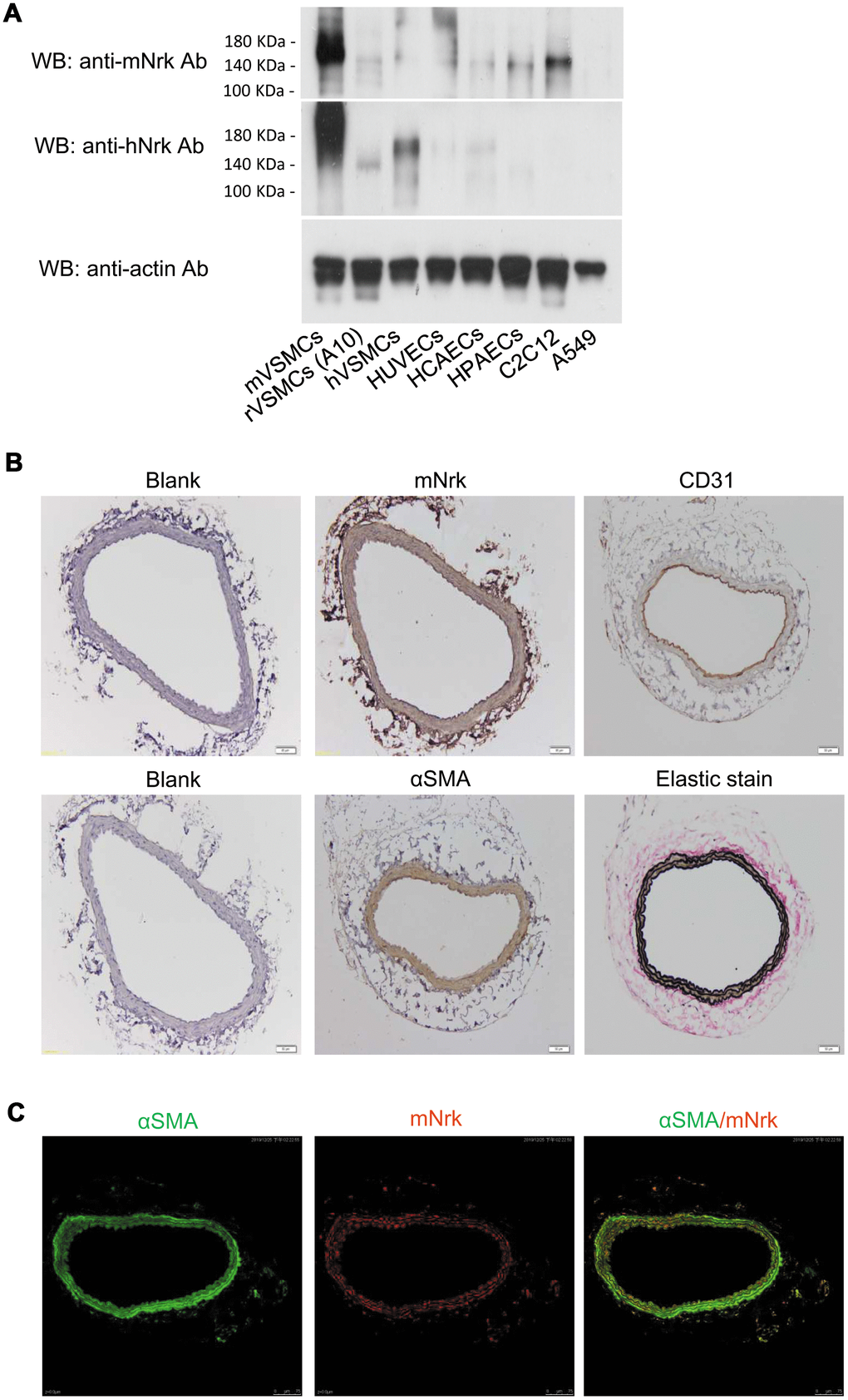 Expression of Nrk in VSMCs. (A) Expression of Nrk protein was determined by western blotting analysis in mVSMCs, rVSMCs (A10), hVSMCs, HUVECs, HCAECs, HPAECs, C2C12 and A549 cells. Primary antibodies against mNrk (upper panel) and hNrk (middle panel) were employed for the detection of Nrk. Actin was used as a loading control (lower panel). (B) Expression of mNrk in normal carotid artery of wild-type C57BL/6 mice was examined by immunohistochemical staining with primary antibodies against mNrk, CD31, αSMA, and elastic stain. Bar= 50 μM. (C) Expression and localization of αSMA (green) and mNrk (red) on mouse carotid artery was examined by double staining of immunofluorescence confocal microscopy.