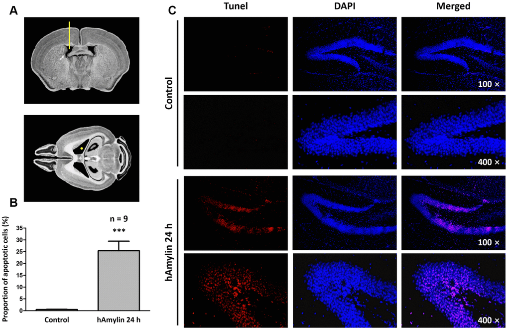 Immunostaining of hippocampal cells in brain slices from adult Kunming mice. (A) The right lateral ventricle was injected with 5 μL of hAmylin (10 μM). (B, C) Twenty-four hours after the intraventricular injection, TUNEL+ cells (markers of apoptosis) in the dentate gyrus of the hippocampus increased significantly.