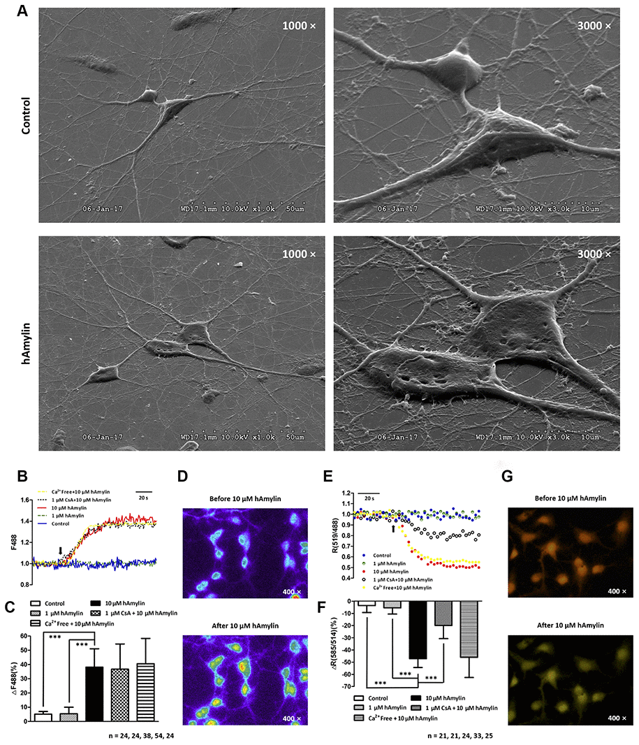 Scanning electron microscopy images of primary cultured hippocampal cells with or without hAmylin (10 μM, 1 h). (A) The plasma membrane was smooth and integral for primary cultured neurons and astrocytes without amylin incubation. After the cells had been treated with hAmylin (10 μM), significant plasma membrane damage was observed on the surface of primary cultured neurons and astrocytes. (B) Intracellular ROS generation induced by 10 μM hAmylin was measured in hippocampal neurons labeled with DCFH-DA dye. Representative traces are shown of the effects of 1 μM hAmylin, 10 μM hAmylin, 10 μM hAmylin + 1 μM CsA and 10 μM hAmylin + free Ca2+ on ROS generation. (C) Significant ROS generation was induced by 10 μM hAmylin, and was not inhibited by 1 μM CsA or free extracellular Ca2+. (D) Changes in neuronal DCFH-DA fluorescence before and after 10 μM hAmylin incubation. (E) The reduction in the mtΔΨ induced by 10 μM hAmylin was measured in hippocampal neurons labeled with JC-1 dye. Representative traces are shown of the effects of 1 μM hAmylin, 10 μM hAmylin, 10 μM hAmylin + 1 μM CsA and 10 μM hAmylin + free Ca2+ on the mtΔΨ. (F) Significant mtΔΨ reduction was induced by 10 μM hAmylin and inhibited by 1 μM CsA, but not by free extracellular Ca2+. (G) Changes in neuronal JC-1 fluorescence before and after 10 μM hAmylin incubation. ***p 