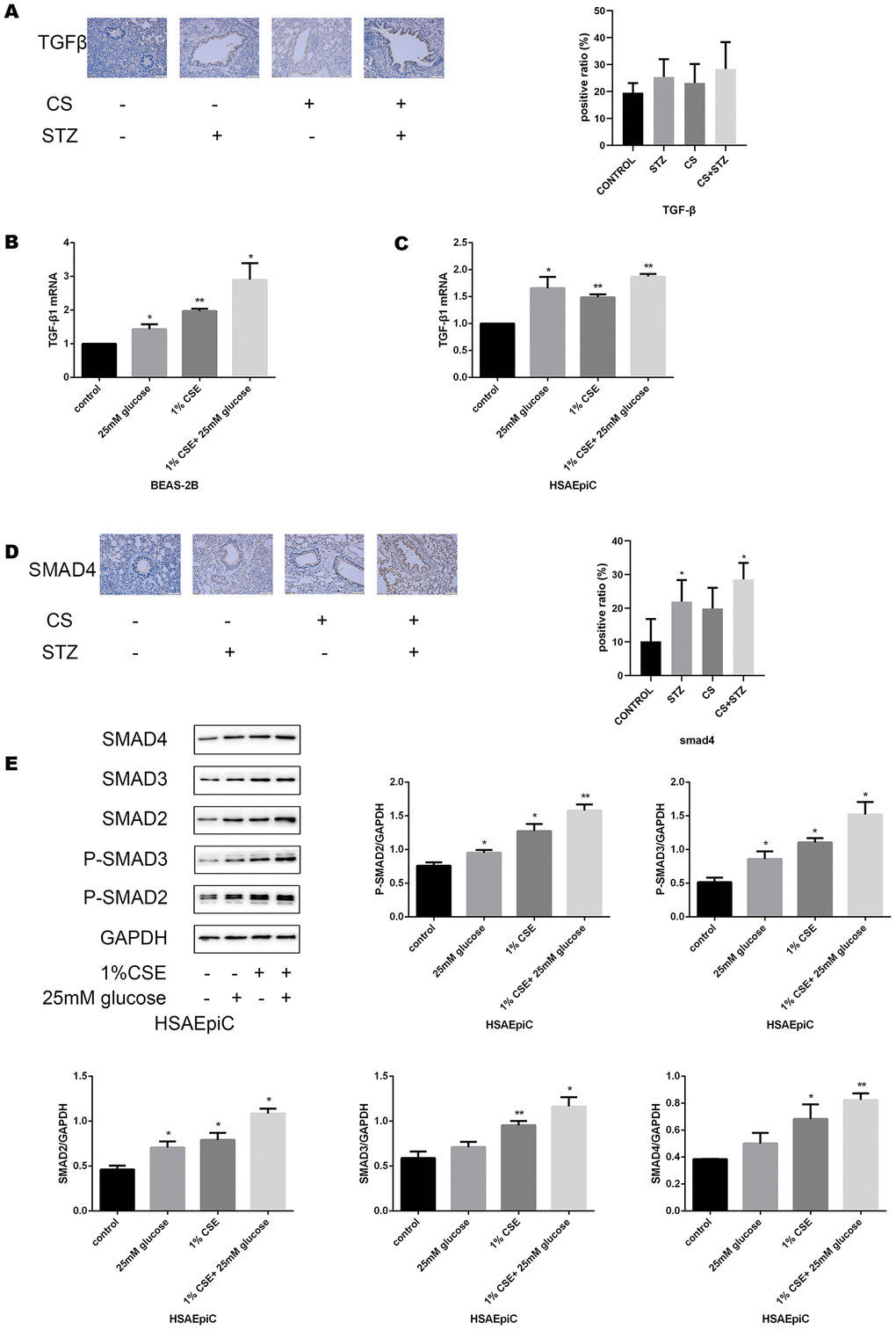 High glucose levels and CS exposure activated the TGF-β signaling pathway. (A) Immunohistochemical results and positive ratios of TGF-β1 in control, COPD, diabetic and COPD diabetic rats. (B, C) AECs were treated with 25 mM glucose, 1% CSE or both for 24 hours. qRT-PCR results of TGF-β1 in BEAS-2B (B) and HSAEpiC (C) cells. (D) Immunohistochemical results and positive ratios of Smad4 in CS-induced COPD, diabetic and COPD diabetic rats. (E–H) AECs were treated with 25 mM glucose, 1% CSE or both for 24 hours.