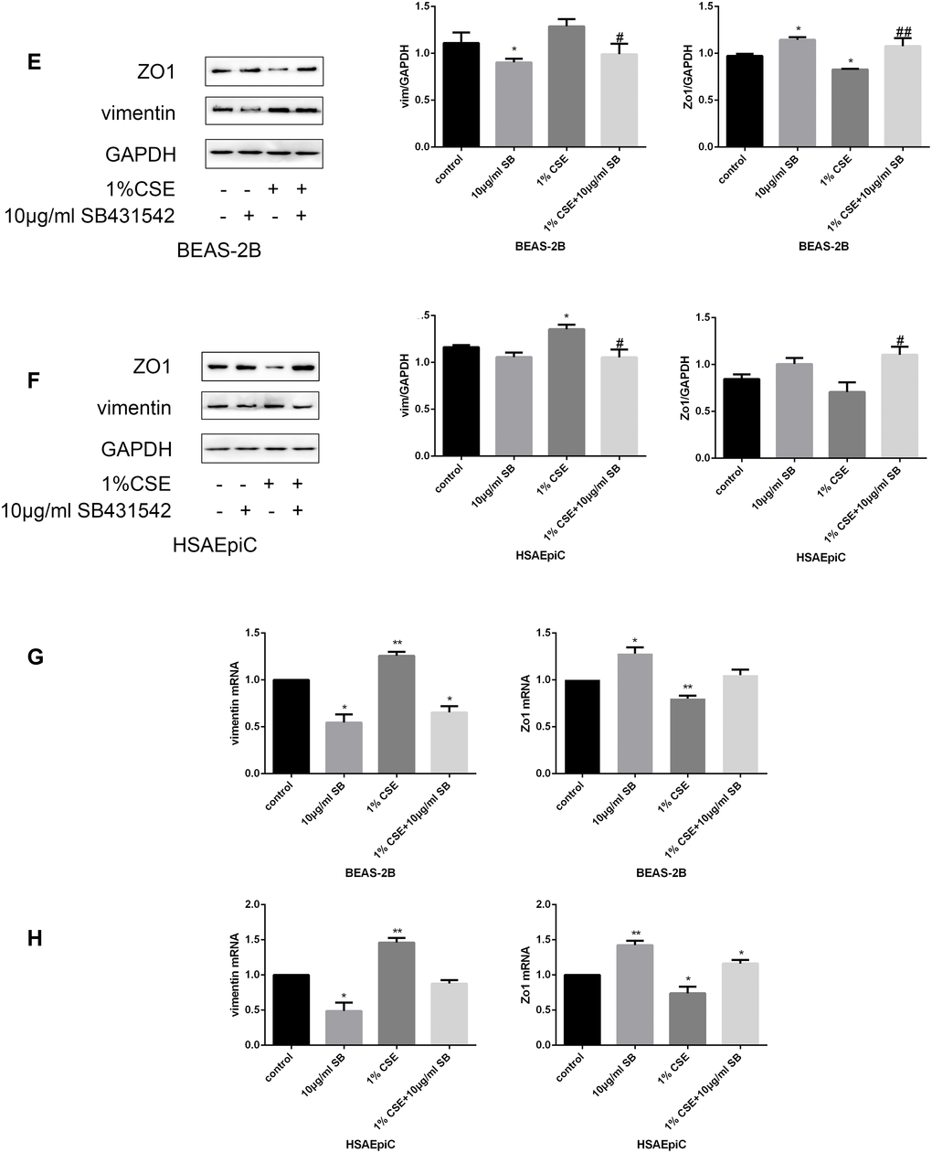 The TGF-β signaling pathway determined the EMT level. (E–H) AECs were treated with 10 μg/mL SB431542 for 30 minutes. Western blots of Zo1 and vimentin in BEAS-2B (E) and HSAEpiC (F) cells. qRT-PCR analyses of Zo1 and vimentin in BEAS-2B (G) and HSAEpiC (H) cells. * p