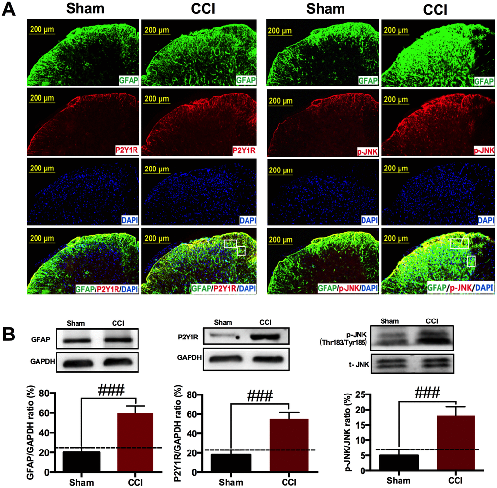 CCI induced astrocytic P2Y1R up-regulation and JNK activation in the spinal cord. (A) Immunostaining showing that CCI injury induced astrocytic marker GFAP expression in the ipsilateral spinal cord on POD 14. JNK phosphorylation and P2Y1R up-regulation occurred accompanied with astrocyte activation. Scale bar=200μm. (B) Western blot showing that GFAP, p-JNK and P2Y1R were increased in CCI group compared with sham group. All data are means ± S.D. ###p