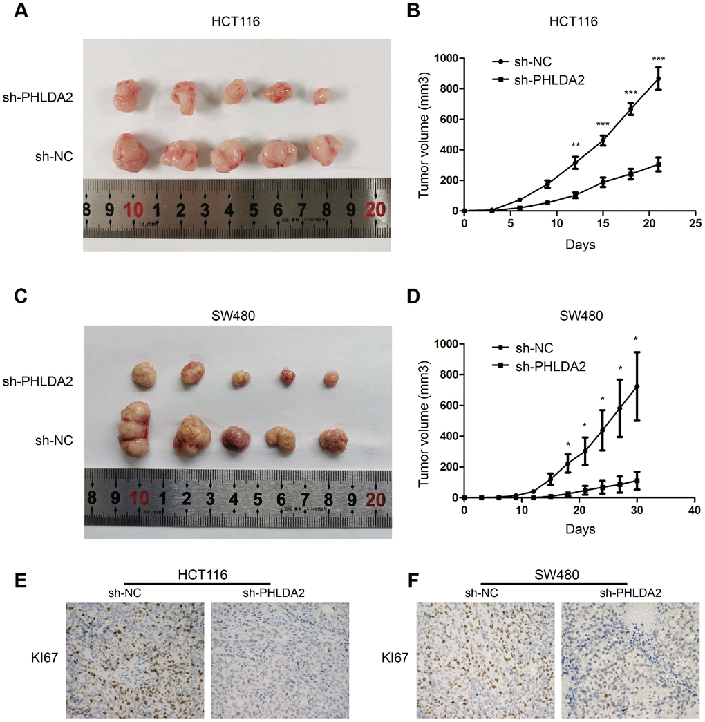 PHLDA2 modulates tumorigenesis autophagy and apoptosis in vivo. (A–D) The volume and growth curve of nude mouse tumors. (E, F) Levels of KI67 proteins in tumors from nude mice. *P PP