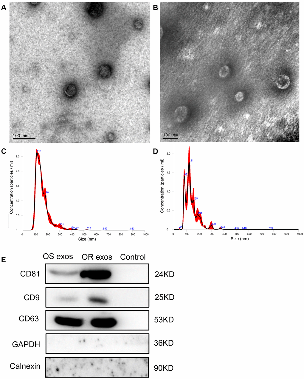 Characterization of exosomes. (A) Representative transmission electron microscopy (TEM) image of exosomes isolated from NSCLC patients before osimertinib treatment. Scale bar: 100 nm; (B) Representative TEM image of exosomes isolated from plasma of osimertinib-resistant NSCLC patients. Scale bar: 100 nm; (C) Nanoparticle tracking analysis of the size of exosomes isolated from NSCLC patients before osimertinib treatment; (D) Nanoparticle tracking analysis of the size of exosomes isolated from plasma of osimertinib-resistant NSCLC patients. (E) Western blot analysis of exosomal marker CD9, CD63 and CD81. Calnexin, which is an integral protein of the endoplasmic reticulum, and GAPDH were used as negative control for identification of exosomes. Supernatant was used as control samples. OS exos: Osimertinib-sensitive exosomes; OR exos: Osimertinib-resistant exosomes.