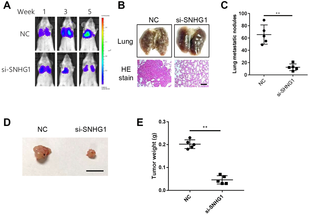 SNHG1 promotes breast cancer cell metastasis and proliferation in vivo. (A) Representative images of cancer metastasis in SCID mice monitored at indicated time points using in-vivo imaging system. (B) Representative images of excised lungs from SCID mice of different groups (top). Representative images of HE staining of lung sections (bottom). Scale bar=400μm. (C) Statistics data of lung nodules of SCID mice (n=5 each group). **pD) Representative images of excised tumors from nude mice. Scale bar=1cm. (E) The mass of xenograft tumors excised from nude mice (n=5 each group). **p