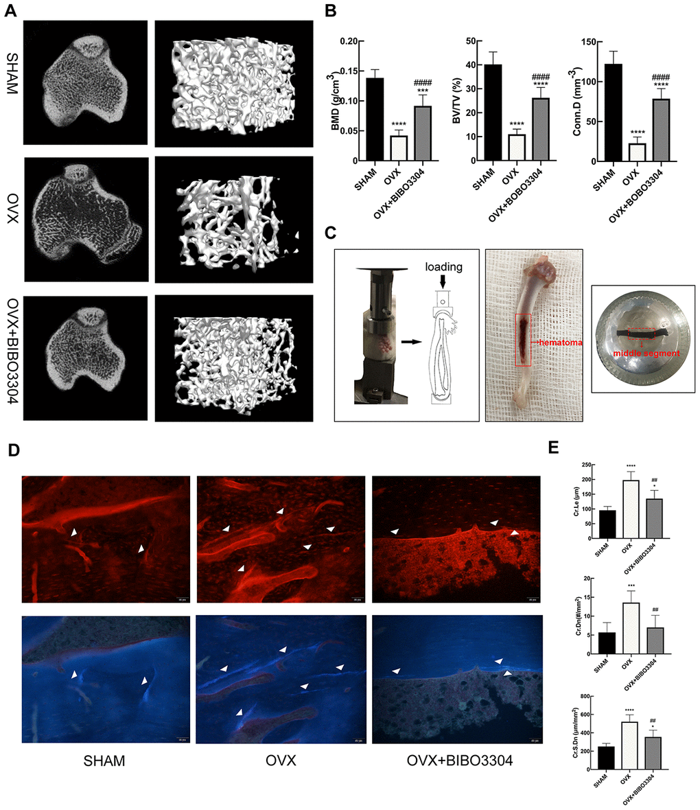 Y1R antagonist treatment improved bone microstructure and decrease microdamage in OVX rats. Representative micro-CT images of rat tibias (A) and quantitative analysis of bone microstructure (B). (C) In vivo fatigue loading model and the position of the sample for microdamage analysis in the rat tibia. Fluorescent images (D) and comparison (E) of microdamage (white arrow head) among groups (x 200). The data are expressed as the means ± SD (n = 6 in each group). *P##P####P