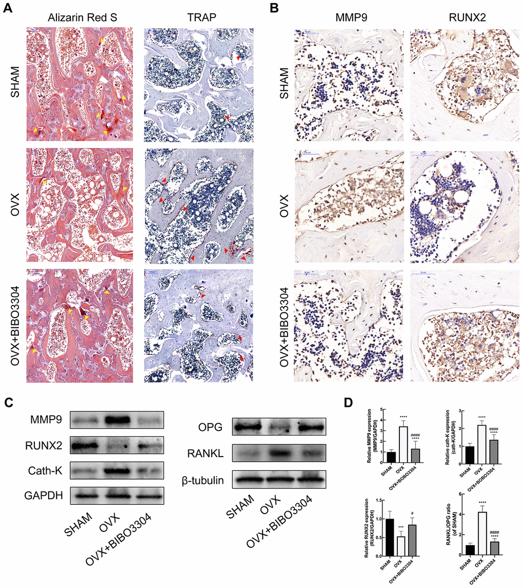 Y1R antagonist treatment promoted bone formation and inhibit bone resorption in OVX rats. (A) The Alizarin Red S (yellow arrow head) and TRAP staining (red arrow head) of bone tissues in groups. (B) Immunohistochemical analysis of bone tissue among groups for MMP9 and RUNX2 (x 400). (C, D) Western blotting results of MMP, RUNX2, Cath-K, OPG and RANKL expression in bone marrow from rat femurs. The data are expressed as the means ± SD (n = 6 in each group). ***P#P####P