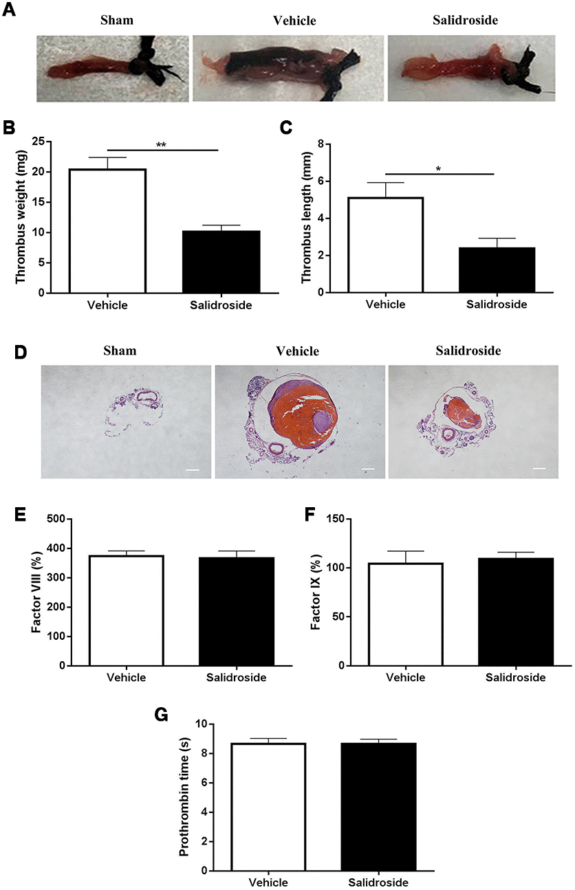 Deep vein thrombus formation and coagulation analysis. After intraperitoneal injection of salidroside (20 mg/kg) or vehicle, mice underwent ligation of inferior vena cava (IVC) to initiate venous thrombus formation. After 24 h, the IVC samples (A, representative IVC from 5 mice) were collected for measuring the thrombus weight (B) and length (C) (n = 5). Meanwhile, the histological assessment of the ligated IVC samples was also performed (magnification x 40, scale bar =1000 μm) (D). In addition, peripheral blood was collected from salidroside or vehicle treated mice for analysis of coagulation factor FVIII (E), FIX (F) and prothrombin time (G) (n = 7). Data were presented as mean ± SE and analyzed by unpaired student t-test.