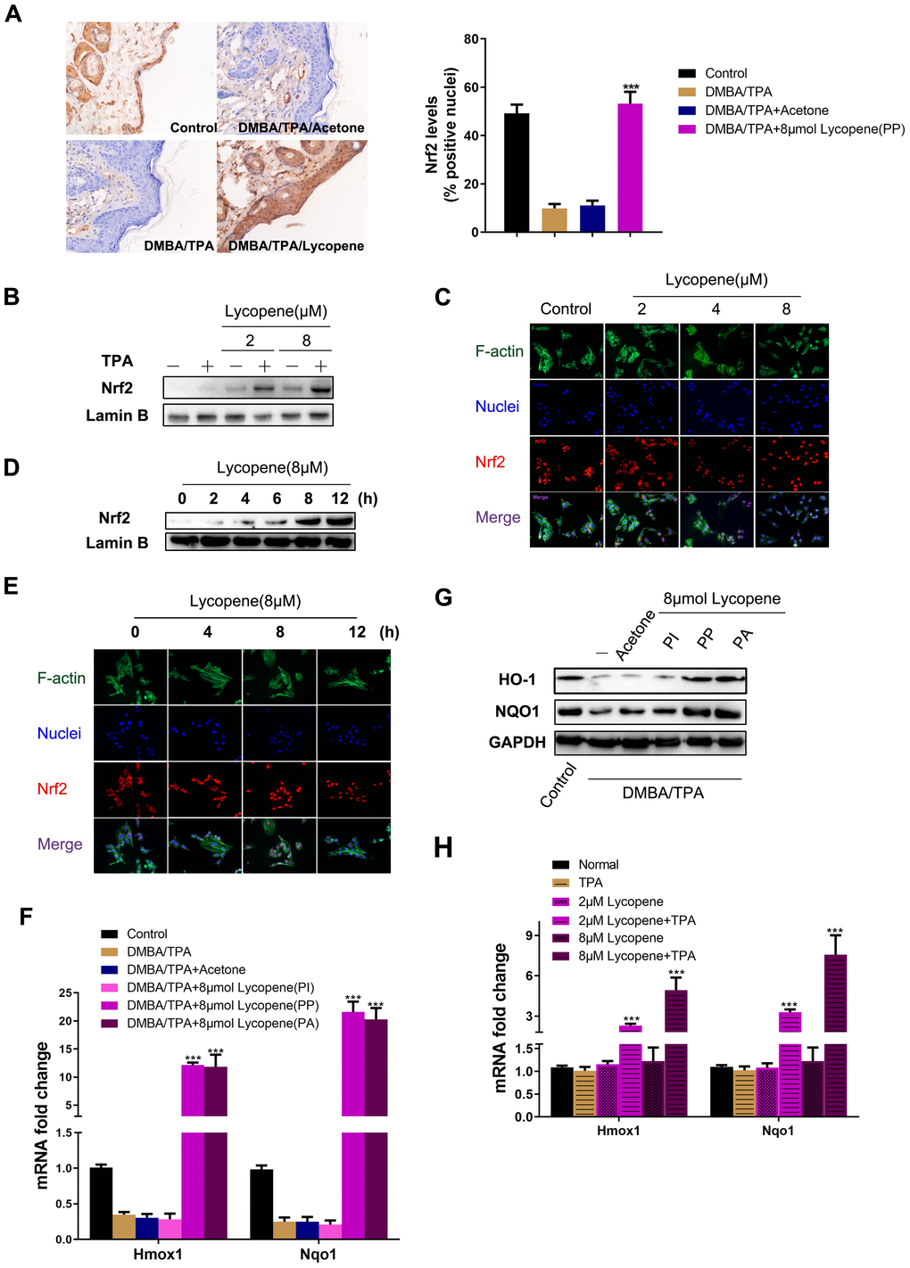 Lycopene activated the Nrf2 pathway in the presence of carcinogens in vivo and in vitro. (A) (Left panel) Representative images of Nrf2 immunohistochemistry staining in mouse epidermis in different groups (magnification 100×). (Right panel) Quantitative analysis of Nrf2 IHC results in left panel (n=9 per group). The data are presented as the mean ± SD. ***p B) JB6 P+ cells were pretreated with increasing doses of lycopene for 12 hours and then exposed with or without TPA for additional 2 hours, and the nuclear levels of Nrf2 and LaminB1 were measured by Western blot. LaminB1 was used as the loading control. (C) JB6 P+ cells were pretreated with increasing doses of lycopene for 12 hours and then exposed with 20 ng/ml TPA for additional 2 hours. The immunofluorescence staining of Nrf2 was conducted as described in Materials and Methods (blue: nuclei, red: Nrf2, green: F-actin). (D) JB6 P+ cells were pretreated with 8 μM lycopene for various times and then exposed with TPA for additional 2 hours, and the nuclear levels of Nrf2 and LaminB1 were measured by Western blot. (E) The immunofluorescence staining of Nrf2. Treatment similar to (D). (F) Quantitative RT-PCR analysis of Nrf2 target genes in the mouse skin of the indicated groups (n=3). The data are presented as the mean ± SD. ***p G) The levels of HO-1 and NQO1 in mouse skin were measured by Western blot. The results were representative of three independent experiments. (H) Treatment similar to (B), and mRNA levels of Hmox1 and Nqo1 were detected by real-time qPCR. GAPDH was used as the loading control. The data are presented as the mean ± SD. ***p 