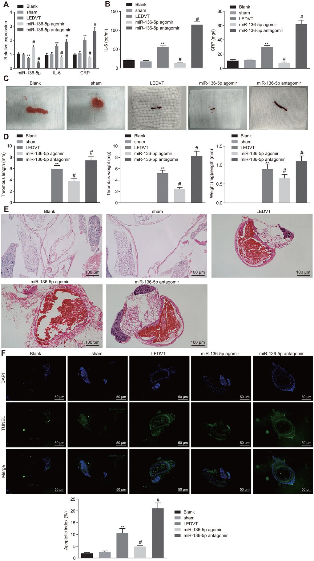 Acute LEDVT is mitigated by the upregulation of miR-136-5p. The rats used for following assays included rats injected with normal saline alone, sham-operated rats, acute LEDVT model rats, and rats treated with miR-136-5p agomir or miR-136-5p antagomir. (A) The expression levels of miR-136-5p, IL-6 and CRP in the vein tissues of rats determined by RT-qPCR. (B) The protein expression levels of IL-6 and CRP in peripheral blood serum of rats determined by ELISA. (C) Images of acute LEDVT in rats. (D) The length, weight, and the ratio of weight to length of the venous thrombus in rats. (E) The pathological changes in vein tissues of rats determined by HE staining (100 ×). (F) The apoptosis of endothelial cells in the femoral vein in rats measured by TUNEL assay (200 ×). ** p p 