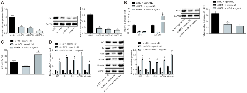 HSF1 positively regulates the expression of miR-214 to affect the proliferation and fibrogenic transformation of HEPFs. (A) The HSF1 expression in HEPFs transfected with three si-HSF1 sequences determined at mRNA and protein levels by RT-qPCR and western blot analysis, respectively. *, p vs. cells transfected with si-NC. (B) The expression of miR-214 and mRNA and protein levels of HSF1 in the HEPFs co-transfected with si-HSF1/si-NC and miR-214 agomir/agomir-NC measured by RT-qPCR and western blot analysis. *, p vs. cells co-transfected with si-NC and agomir NC, #, p vs. cells transfected with si-HSF1 and agomir NC. (C) The viability of HEPFs co-transfected with si-HSF1/si-NC and miR-214 agomir/agomir-NC assessed by CCK8 experiment. *, p vs. cells co-transfected with si-NC and agomir NC, #, p vs. cells co-transfected with si-HSF1 and agomir NC. (D) The mRNA and protein levels of cell proliferation marker Ki67 and fibrosis biomarkers CoI, CoIII, α-SMA and vimentin in the HEPFs co-transfected with si-HSF1/si-NC and miR-214 agomir/agomir-NC assessed by qRT-PCR and western blot analysis, respectively. *, p vs. cells co-transfected with si-NC and agomir NC, #, p vs. cells co-transfected with si-HSF1 and agomir NC. Statistical data were measurement data, and presented as mean ± standard deviation. Unpaired t-test was used for comparison between the two groups, and one-way ANOVA with Tukey's post hoc test was employed for comparisons among multiple groups. The experiment was independently repeated three times.