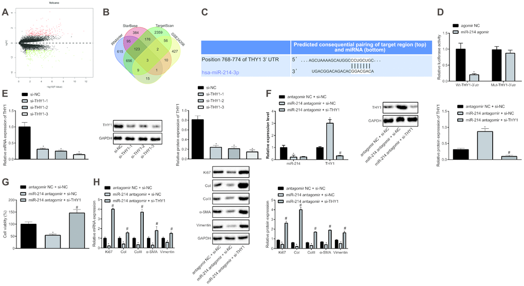 Inhibition of miR-214 up-regulates THY1 to retard the proliferation and fibrogenic transformation of HEPFs. (A) Volcano map of the DEGs in the IPF obtained from microarray GSE24206, the abscissa represented the different log10 p value, the ordinate indicated logFC. Each dot in the map represented a gene, where red dots represent the up-regulated gene, and green dots represent the down-regulated gene in the IPF sample; (B) Venn diagram showing target genes of miR-214 predicted by TargetScan database, StarBase database and RNAInter database, respectively and DEGs in the IPF obtained from microarray GSE24206 and the intersection gene among those four sets; (C) The possible binding sites of miR-214 and THY1 predicted by TargetScan database; (D) The binding region between miR-214 and THY1 obtained from TargetScan database, and their relationship was verified by dual-luciferase reporter assay using recombinant Wt-THY1-3’UTR and Mut-THY1-3’UTR. *, p vs. cells transfected with agomir NC; (E) The THY1 mRNA and protein levels in HEPFs transfected with three si-THY1 sequences determined by RT-qPCR and western blot analysis, respectively. *, p vs. cells transfected with si-NC; (F) The expression of miR-214 and mRNA expression of THY1 measured by RT-qPCR, and the protein expression of THY1 assessed by western blot analysis in the HEPFs co-transfected with si-THY1/si-NC and miR-214 antagomir/antagomir-NC. *, p vs. cells co-transfected with si-NC and agomir NC, #, p vs. cells co-transfected with miR-214 antagomir and si-NC; (G) The viability of HEPFs co-transfected with si-THY1/si-NC and miR-214 antagomir/antagomir-NC evaluated by CCK8 experiment. *, p vs. cells co-transfected with antagomir NC and si-NC, #, p vs. cells co-transfected with miR-214 antagomir and si-NC; (H) The mRNA and protein levels of cell proliferation marker Ki67 and fibrosis biomarkers CoI, CoIII, α-SMA and vimentin in the HEPFs co-transfected with si-THY1/si-NC and miR-214 antagomir/antagomir-NC assessed by qRT-PCR and western blot analysis. *, p vs. cells co-transfected with antagomir NC and si-NC, #, p vs. cells co-transfected with miR-214 antagomir and si-NC. Statistical data were measurement data, and presented as mean ± standard deviation. Unpaired t-test was used for comparison between the two groups, and one-way ANOVA with Tukey's post hoc test was employed for comparisons among multiple groups. The experiment was independently repeated three times.