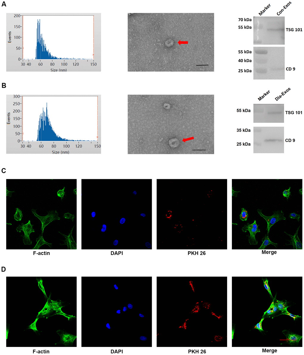 Features of exosomes derived from non-diabetic and diabetic patients. (A) DLS results, TEM images and WB results of Con-Exos. (B) DLS results, TEM images and WB results of Dia-Exos; scale bar: 100 nm. (C) PKH26-labeled Con-Exos were absorbed by HUVECs, as indicated by a red fluorescent signal. (D) PKH26-labeled Dia-Exos were taken up by HUVECs, as indicated by a red fluorescent signal.
