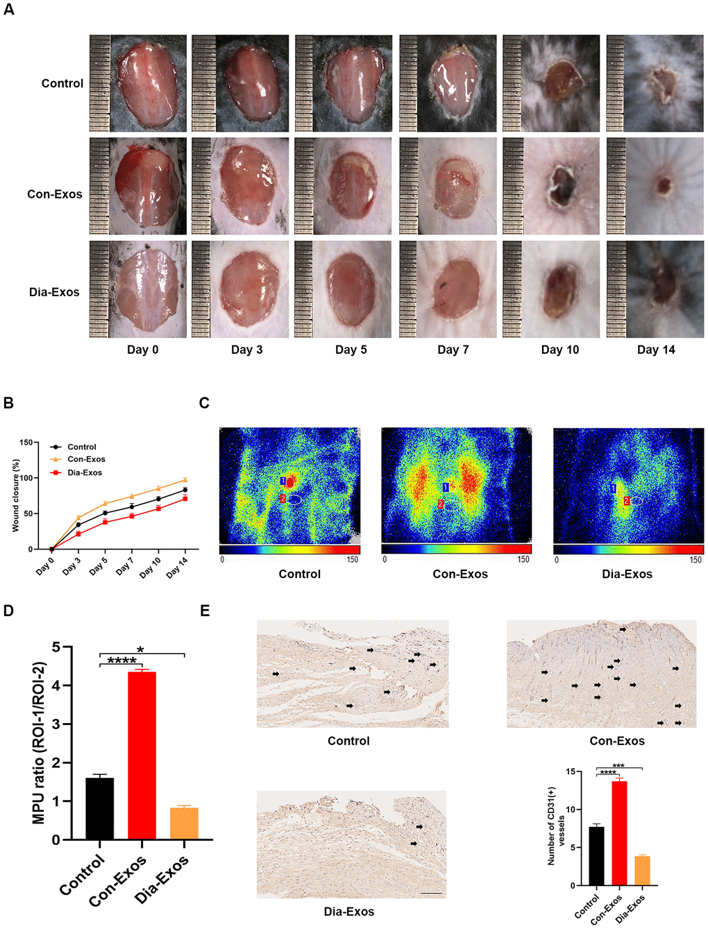 Dia-Exos hindered wound healing in vivo. (A) General view of wound closure after different treatments. Wounds are shown on days 0, 3, 5, 7, 10 and 14 post-wounding. (B) The wound closure rates of the three groups; n = 6 per group. (C, D) The MPU ratio at the wound area in each group was assessed through small animal doppler detection. The MPU ratio is the MPU of the wound area (region of interest 1) divided by the MPU of the area around the wound (region of interest 2). n = 6 per group. (E) Immunohistochemical analysis of CD31 in the wound site after different treatments. The number of CD31-positive cells was quantified in five random fields of view. Vessels with diameters of 2-10 μm were counted as individual vessels. n = 6 per group; scale bar: 100 μm. Data are the means ± SDs of three independent experiments. *p 