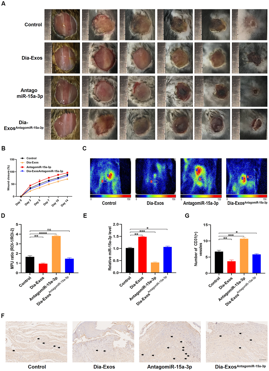 Knockdown of miR-15a-3p partially reversed the negative effects of Dia-Exos on wound healing in vivo. (A) General view of the wounds among in the four groups on days 0, 3, 5, 7, 10 and 14 post-wounding; n = 6 per group. (B) The mice of wound closure in the four groups were quantified using digital images evaluated with ImageJ software; n = 6 per group. (C, D) The blood flow at the wounds in the four groups was evaluated using small animal doppler detection; n = 6 per group. (E) The expression of miR-15a-3p in the wound tissues of the four groups. (F, G) CD31 immunohistochemistry results of the four groups. The number of CD31-positive cells was quantified in five random fields of view. Vessels with diameters of 2-10 μm were counted as individual vessels. n = 6 per group; scale bar: 100 μm. Data are the means ± SDs of three independent experiments. *p 