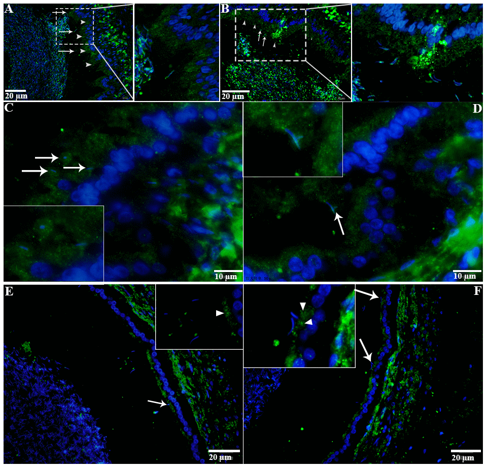 LC3 localization in the epididymis of turtle. LC3 immunolabeling (white arrowhead) in the epididymis during hibernation (A–C) and non-hibernation. (E, F) White arrow indicates interaction of luminal spermatozoa with epithelia of epididymis. Rectangular area showed enlarged area. Scale bar: (A, B, E, F) 20 μm and (C, D) 10 μm.