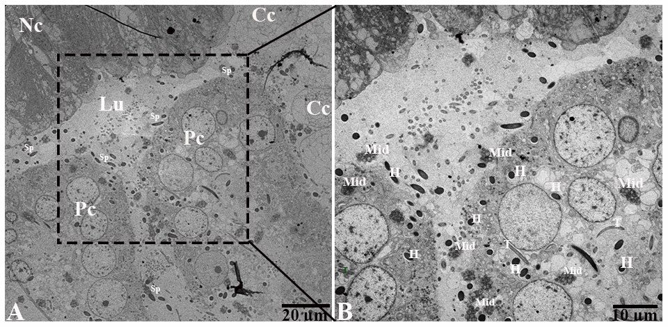 Transmission electron micrograph of epididymis during hibernation. Cc: clear cell; Lu: lumen, Nc: narrow cell, Pc: principal cell, Sp: spermatozoa (H: head, Mid: midpiece, T: tail). Scale bar: (A) 20 μm and (B) 10 μm.