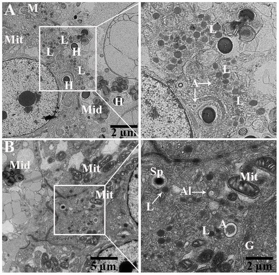 Transmission electron micrograph of Spermatozoa within cytoplasm of principal cells of epididymis. Al: autolysosome; G: Golgi complex; L: lysosome, Mit: mitochondria, Sp: spermatozoa (H: head, Mid: midpiece, T: tail). Rectangular area showed enlarged area. Scale bar: (A) 5 μm and (B) 5 μm and 2 μm.