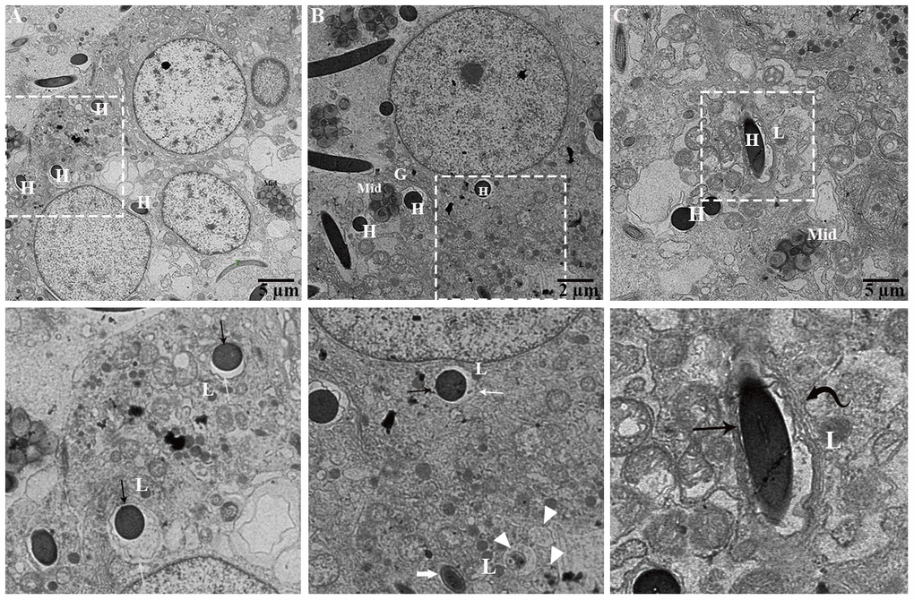 Ultrastructure: Formation of concentric layer around sperm heads undergoing engulfment. Al: autolysosome; Cd: cytoplasmic droplet of spermatozoa, L: lysosome, Mit: mitochondria, Sp: spermatozoa (H: head, Mid: midpiece, T: tail). Rectangular area showed enlarged area. Black arrow: interconnected zone, White arrow: electron translucent zone, Curved black arrow: numerous concentric layers around spermatozoa head, Thick white arrow: reduced electron translucent zone, Arrowhead: autophagic activity. Scale bar: (A, C) 5 μm and (B) 2 μm.
