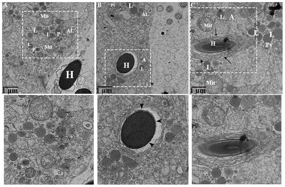 Ultrastructure: Lysosomal and autophagic activity around spermatozoa. A: autophagosome; Al: autolysosome; G: Golgi complex; H: Head of spermatozoa; L: lysosome, Mit: mitochondria; P: phagolysosome. Rectangular area showed enlarged area. Arrow: numerous concentric layers around spermatozoa, Sharp arrow: degenerate segment of spermatozoa, Arrowhead: lysosomal attachment with spermatozoa. Scale bar: (A–C) 1 μm.