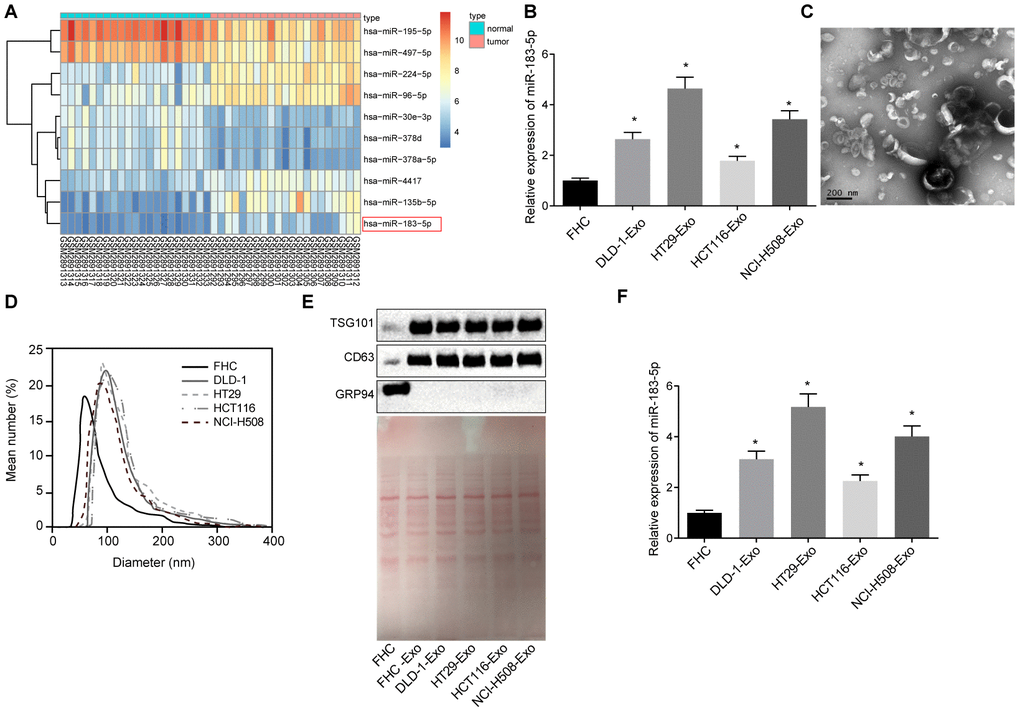 Exosomes secreted from CRC cells exhibit high expression of miR-183-5p. (A) heatmap of differentially expressed miRNA screened from GSE108153, with the horizontal coordinate representative of the sample number; the longitudinal coordinate reflective of the differentially expressed miRNA; the color gradation histogram on the right indicative the level of gene expression where each box in the diagram indicates the expression level of a gene in a sample. The warmer color reflected the higher expression, and the colder color reflected the lower expression; (B) expression of miR-183-5p in CRC cell lines detected via RT-qPCR; (C) identification of structure of exosomes by transmission electron microscopy; (D) analysis of size distribution of exosomes was conducted by NanoSight NS300 Nanoparticle Tracking Analyzer; (E) protein bands and expression of TSG101, CD63 and GRP94 as detected by Western blot analysis; (F) expression of miR-183-5p in exosomes secreted from CRC cells detected via RT-qPCR; * p 