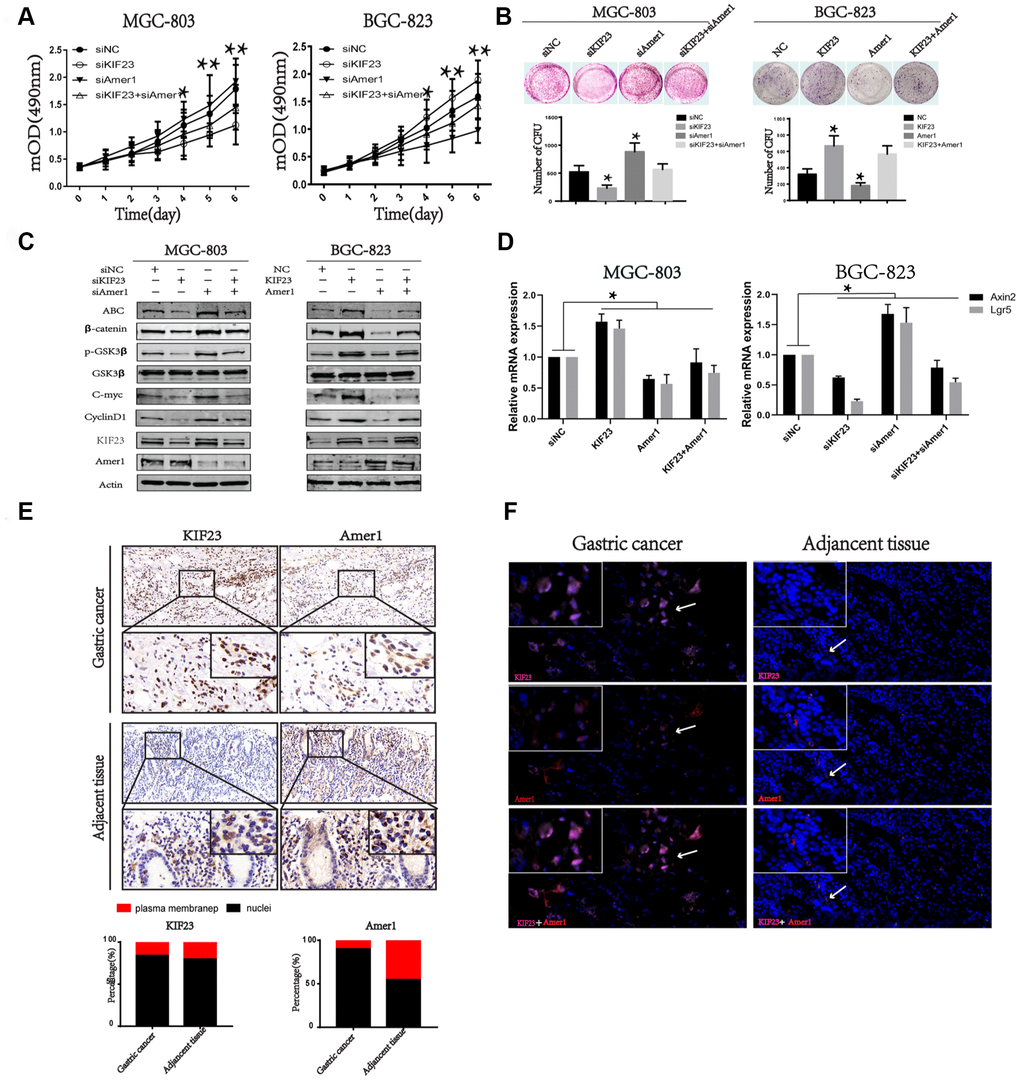 KIF23 promoted GC cells proliferation via binding with Amer1 and disturbing its distribution. Effects of cotransfection of KIF23-siRNA and Amer1-siRNA or KIF23and Amer1 overexpression plasmids on cell growth (A) and colony formation assay (B). (C) Western blot analysis of the activity of Wnt/β-catenin signaling pathway and its target proteins after cotransfection of KIF23-siRNA and Amer1-siRNA or KIF23 and Amer1 overexpression plasmids. (D) Q-PCR analysis of effects of cotransfection of KIF23-siRNA and Amer1-siRNA or KIF23and Amer1 overexpression plasmids on Wnt targets Axin2 and Lgr5. IHC (E) and IF (F) were used to analyze the expression and distribution of KIF23 and Amer1 in GC and adjacent normal tissues.