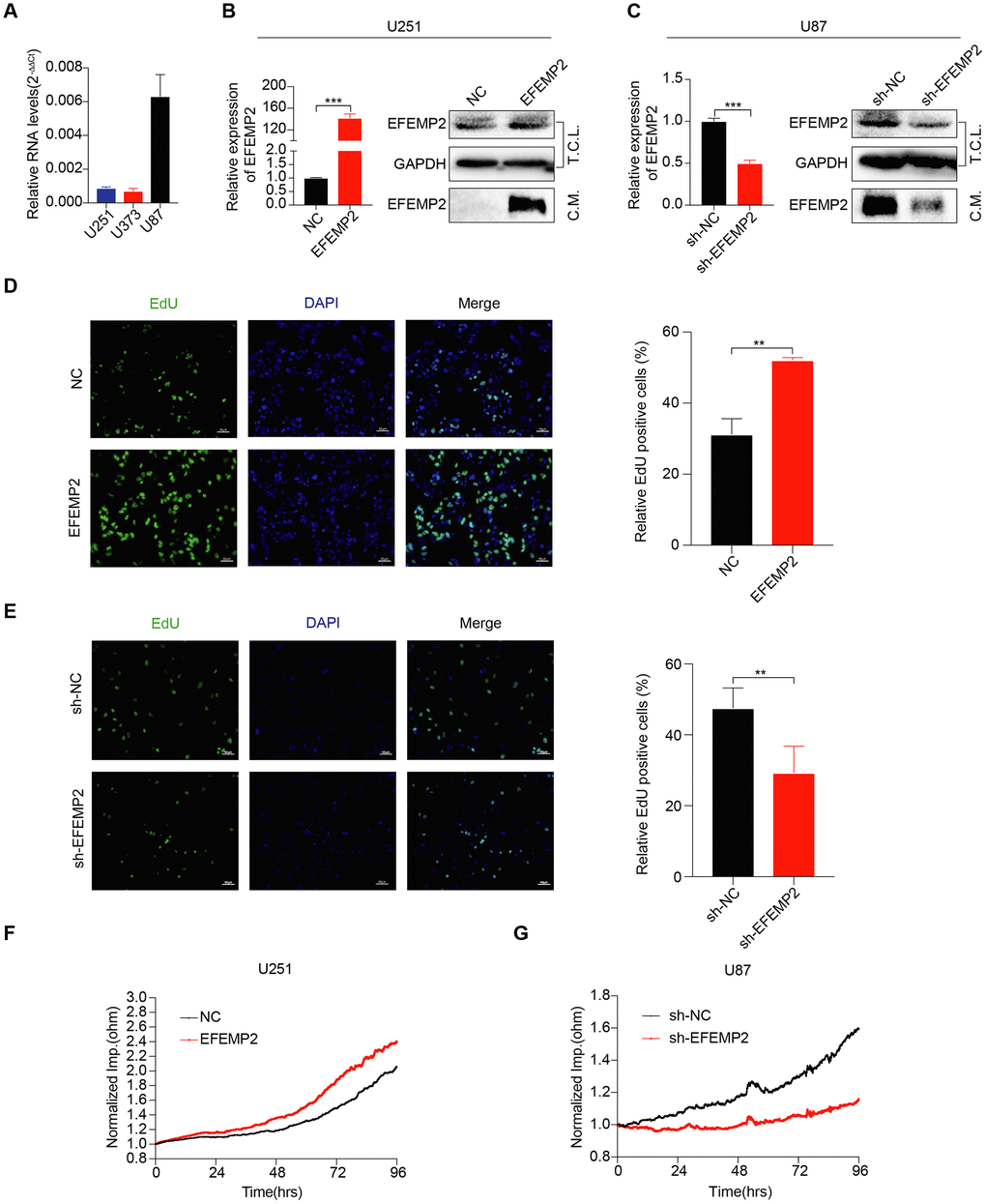 EFEMP2 promotes GBM cell proliferation. (A) The expression of EFEMP2 was detected in three GBM cell lines by RT-qPCR. GAPDH was used as an internal reference. (B) RT-qPCR analysis of EFEMP2 expression in U251 cells overexpressing EFEMP2. Statistical significance was assessed using two-tailed Student’s t test. ***P C) RT-qPCR analysis of EFEMP2 expression in U87 cells knocking down EFEMP2. Statistical significance was assessed using two-tailed Student’s t test. ***P D and E) Proliferation of stable overexpressing (D) or knockdown (E) EFEMP2 cells as measured by EdU (green) uptake. Quantification of proliferation was measured by % EdU expressing cells / total cell number. Statistical significance was assessed using two-tailed Student’s t test. **P F and G) The growth of cells with stable overexpressing (F) or knockdown (G) EFEMP2 was measured by Electric Cell-substrate Impedance Sensing (ECIS).