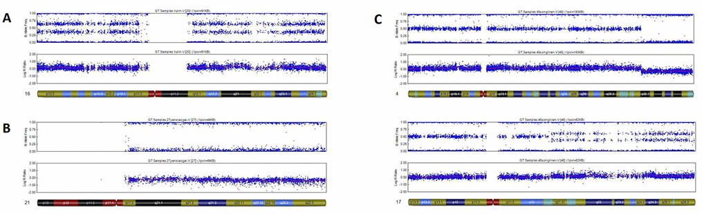 Representative examples of SNP results. (A) Single trisomy of chromosome 16. (B) Monosomy autosome (a monosomy of chromosome 21). (C) Complex abnormalities: Structural deletion with duplication.