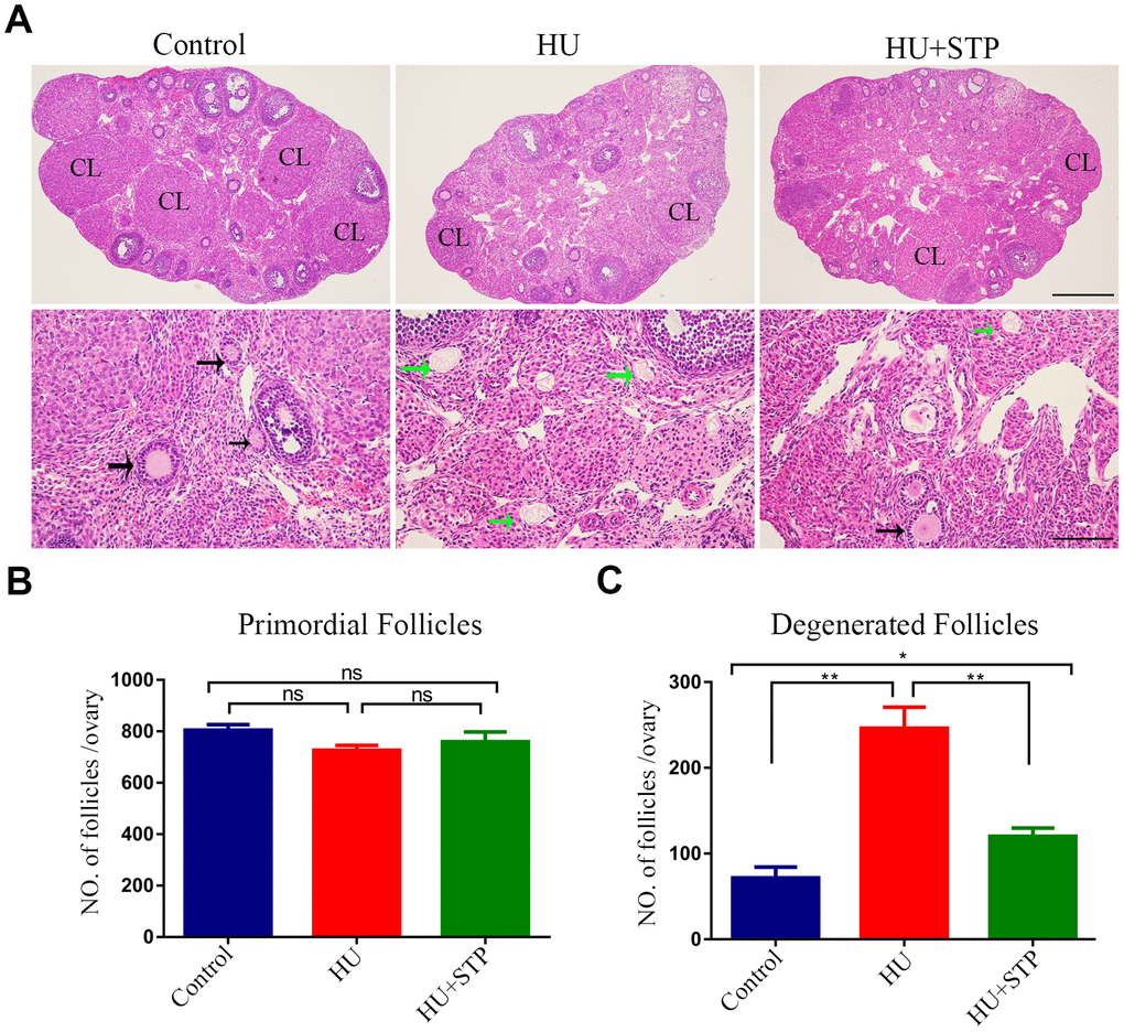 Effects of STP on the follicle development in HU-exposed ovaries. (A) Histology of ovarian sections in control, HU-exposed and STP-supplemented ovaries. Ovarian sections of 4 μm thickness were prepared and stained with H&E. Black arrows show the growing follicles at different developmental stages; green arrows indicate the developmentally arrested follicles with degenerating oocytes. CL, corpus luteum. Scale bars, 250 μm and 50 μm. (B) Quantification analysis of primordial follicles in control, HU-exposed and STP-supplemented ovaries. (C) Quantification analysis of degenerated follicles in control, HU-exposed and STP-supplemented ovaries. Data of (B, C) were presented as mean percentage (mean ± SEM) of at least three independent experiments. *P 
