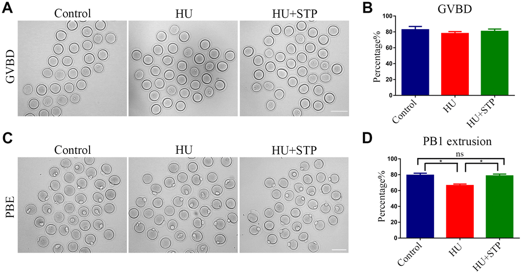 Effects of STP on the meiotic progression of HU-exposed oocytes. (A) Representative images of oocytes which underwent GVBD (germinal vesicle breakdown) in control, HU-exposed and STP-supplemented groups. Scale bar, 120 μm. (B) The rates of GVBD were recorded in control, HU-exposed, and STP-supplemented oocytes. (C) Representative images of oocytes which extruded the first polar body (PB1) in control, HU-exposed and STP-supplemented groups. Scale bar, 120 μm. (D) The rates of PBE (polar body extrusion) were recorded in control, HU-exposed, and STP-supplemented oocytes. Data of (B, D) were presented as mean percentage (mean ± SEM) of at least three independent experiments. *P 