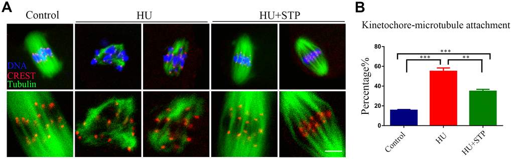 Effects of STP on the kinetochore-microtubule attachment in HU-exposed oocytes. (A) Representative images of kinetochore-microtubule attachment in control, HU-exposed, and STP-supplemented oocytes. Oocytes were immunostained with α-tubulin-FITC antibody to visualize the spindles, with CREST to display the kinetochores, and counterstained with Hoechst to visualize the chromosomes. Scale bar, 5 μm. (B) The rates of defective kinetochore-microtubule attachments were recorded in control, HU-exposed, and STP-supplemented oocytes. Data were presented as mean percentage (mean ± SEM) of at least three independent experiments. **P 