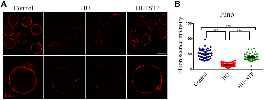 Effects of STP on the distribution of Juno in HU-exposed oocytes. (A) Representative images of Juno dynamics in control, HU-exposed, and STP-supplemented oocytes. Juno was immunostained with rat monoclonal anti-mouse Folr4 antibody and examined by confocal microscopy. Scale bar, 40 and 20 μm. (B) The immunofluorescence intensity of Juno signals was recorded in control, HU-exposed, and STP-supplemented oocytes. Data were presented as mean percentage (mean ± SD) of at least three independent experiments. ***P 