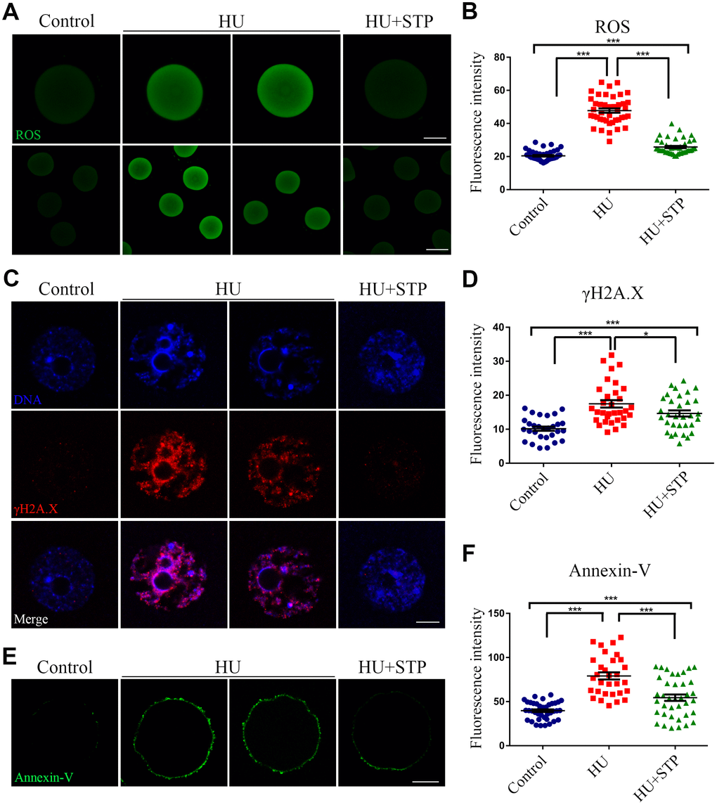 Effects of STP on the ROS level, DNA damage and early apoptosis in HU-exposed oocytes. (A) Representative images of ROS signals in control, HU-exposed, and STP-supplemented oocytes. Scale bar, 20 and 40 μm. (B) The fluorescence intensity of ROS in control, HU-exposed and STP-supplemented oocytes was measured by confocal microscopy using identical settings and parameters. (C) Representative images of γH2AX foci in control, HU-exposed, and STP-supplemented oocytes. Scale bar, 5 μm. (D) The fluorescence intensity of γH2AX signals was measured in control, HU-exposed, and STP-supplemented oocytes. (E) Representative images of apoptotic oocytes in control, HU-exposed, and STP-supplemented oocytes. Scale bar, 20 μm. (F) The rates of apoptotic oocytes were recorded in control, HU-exposed, and STP-supplemented oocytes. Data of (B), (D), and (F) were presented as mean percentage (mean ± SD) of at least three independent experiments. *P 