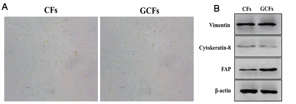 Characteristics of control and GC fibroblasts. (A) The morphology of fibroblasts from healthy control gastric tissues (CFs) and gastric cancer (GCFs) tissues. (B) The expressions of vimentin (fibroblastic marker), cytokeratin-8 (epithelial marker), and fibroblast activation protein (FAP; cancer-associated fibroblasts marker).
