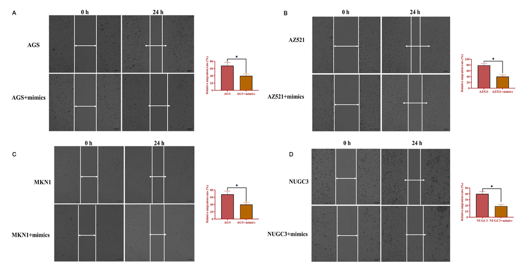 Overexpression of miRNA-34 inhibits the ability of migration of GC cell lines. (A–D) The ability of migration of GC cell lines transfected with miRNA-34 mimics. Values are means ± SD; *, P 